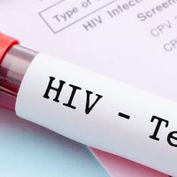 Universidad de Chile tendrá test gratuitos de VIH para estudiantes