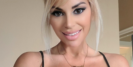 Esta mujer gastó más de 70 millones de pesos en operaciones para parecerse a Pamela Anderson