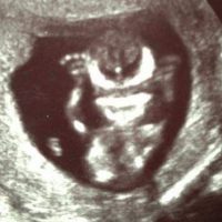 ¡Se vienen los simbiontes! Se viraliza ecografía y el bebe es igual a Venom