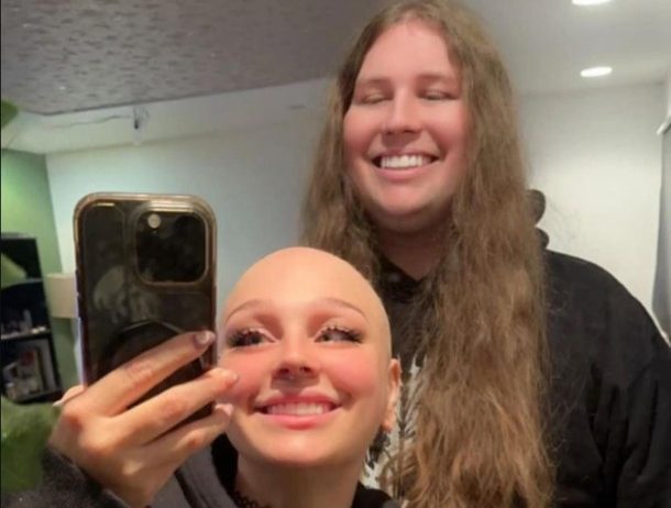 Este si es amor verdadero: Hombre deja crecer su cabello para su novia con alopecia