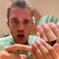 ¡Contrajo una bacteria mortal por comerse las uñas!