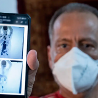¡Hay esperanza, sres! Hombre se curó de cáncer en sólo un mes con tratamiento experimental