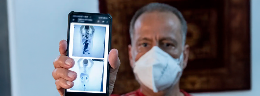 ¡Hay esperanza, sres! Hombre se curó de cáncer en sólo un mes con tratamiento experimental