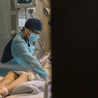Trabajador TEA fue atado, rapado y quemado en hospital de Osorno