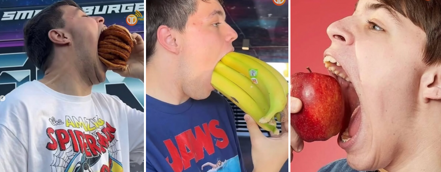 El adolescente con la boca más grande del mundo rompe récord Guinness