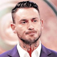 Mauricio Pinilla revela diagnóstico de cáncer de piel