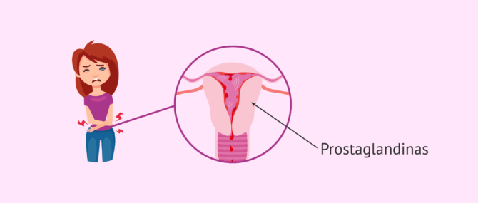 Dolores menstruales podrían ser peores que un ataque al corazón