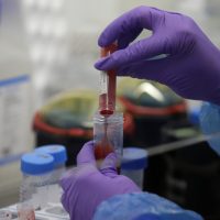 La sangre menstrual tendría más de mil proteínas