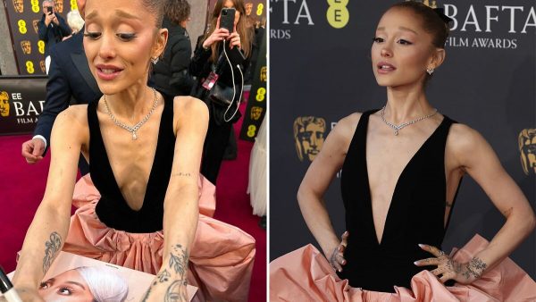 La extrema delgadez vuelve a preocupar en Hollywood