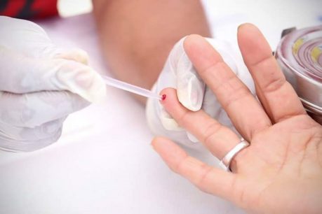 6.430 nuevos casos de VIH fueron detectados en 2018