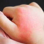 ¿Cómo detectar si mi hijo(a) tiene PIMS? Una experta lo explica