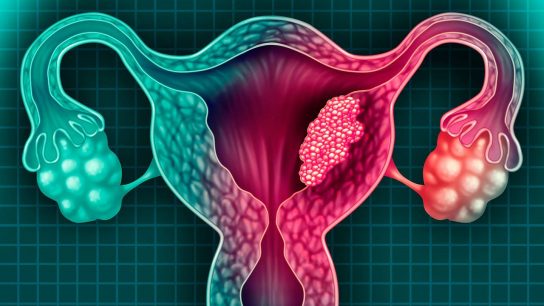 Dr. Rafael Jensen sobre el cáncer cervicouterino: “Se ha visto un aumento que se pudo haber prevenido”