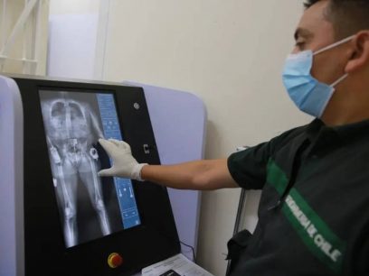 Body Scan: La polémica decisión que tuvo que retractar el ministerio de Salud