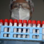 Balance de coronavirus: Reportan 3 personas fallecidas y más de 4 mil nuevos contagios