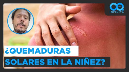 ¿Cuáles son las principales causas del melanoma? Advierten sobre quemaduras solares en la infancia