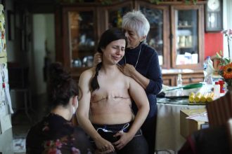 Una cruda realidad: Fotografía que retrata el cáncer de mamas fue ganadora en los premios Ortega y Gasset