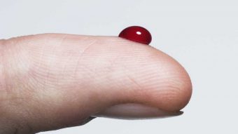 ¿Sangre Dorada? La rara característica que ha sido encontrada unas 50 veces en el mundo