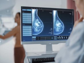De manera bienal hasta los 74: Recomiendan a mujeres realizarse mamografías a partir de los 40 años