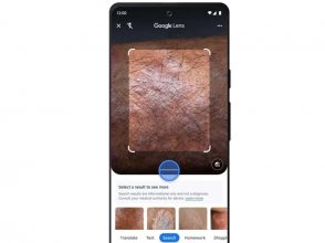 Una herramienta de autodetección: Google Lens incorpora la función de detectar enfermedades de piel