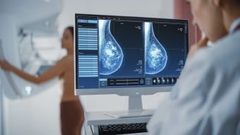 Mujeres deberían comenzar a hacerse mamografías a los 40 años, indican expertos